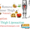 inner thigh liposuction
