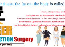Break up and suck the fat out the body is called Liposuction