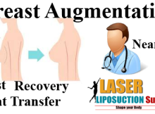 Breast augmentation Surgery Near Me fat transfer Cost Recovery
