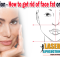 Cheek Liposuction - how to get rid of face fat or chubby cheeks