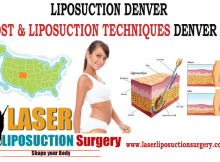 Liposuction Denver Cost Technique