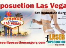 Liposuction-Las-Vegas-Laserliposuctionsurgery