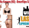 Liposuction Wichita Kansas (KS) - Smartlipo Cost & Procedure