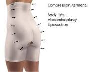 Compression garments after liposuction