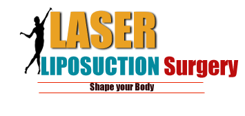 laser liposuction