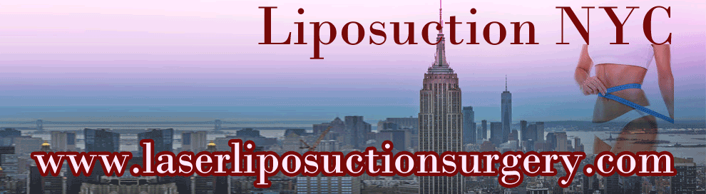 Liposuction NYC